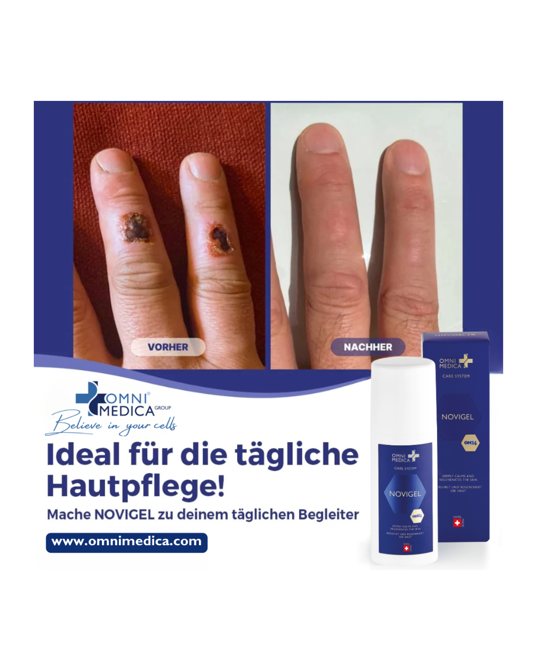 Novigel - Hautregenerations- und Zellschutzserum